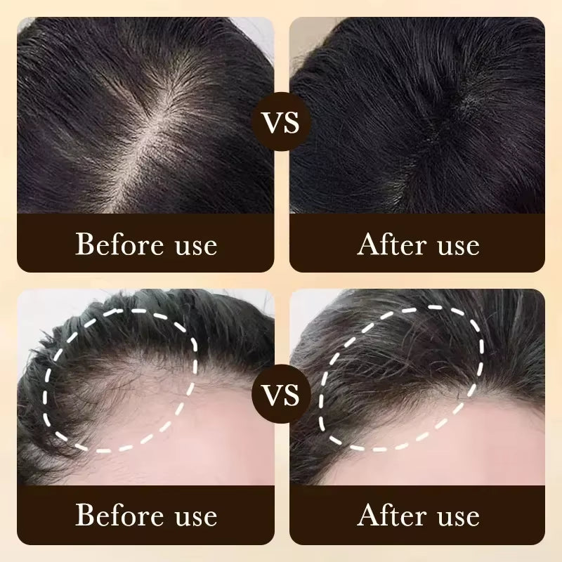 Biotin Fast Hair Growth Oil Products Care Scalp Massage Treatments anti Hair Loss Effective Grow Thicker Hair Serum for Men